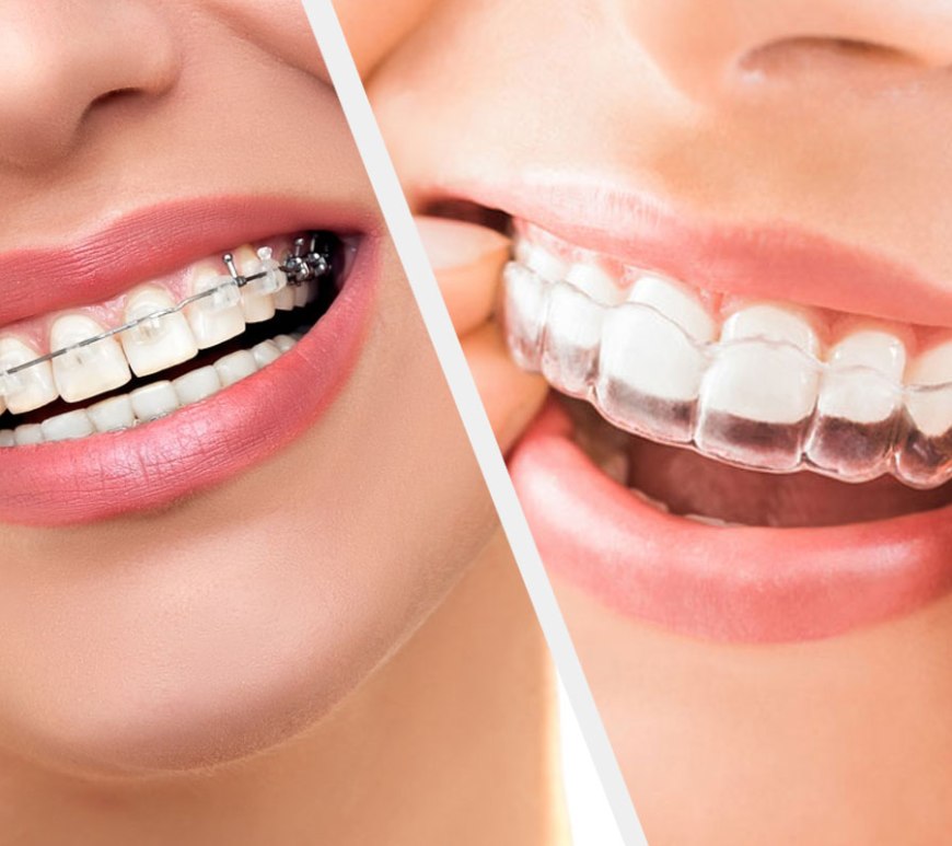 Orthodontic Treatment